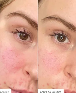 Ren Evercalm Barrier Support Elixir 30ml