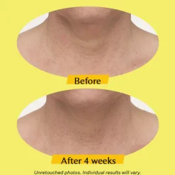 Strivectin TL Advanced™ Tightening Neck Cream PLUS 50ml